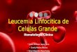 Leucemia Linfocitica de Celulas Grandes Granulares