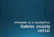 Diabetes Insípida Central