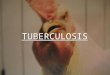 TUBERCULOSIS. Introducción Es una enfermedad contagiosa causada por Mycobacterium avium. Se caracteriza por su cronicidad, persistencia cuando se establece