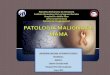 Patologías Malignas de La Glándula Mamaria