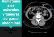 Hematomas de Músculos y Tumores de Pared Abdominal