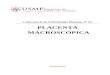 Placenta Macroscópica