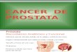 Oncología - Cancer de Próstata