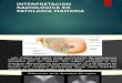 Interpretación Radiológica en Patología Mamaria