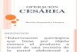 Cesarea Exposicion