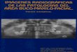 Imágenes Radiográficas de Las Patologías Del Área Buco-Maxilofacial (Copia de NXPowerLite)