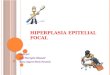 hiperplasia epitelial focal