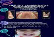 Morfologia de La Denticion Decidua