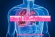 Alto al tbc pulmonar prevención terciaria
