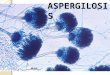 Clase 19 aspergilosis y neumocystosis 2015