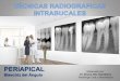 Técnica radiografica intrabucal periapical bisectriz del ángulo