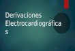 Derivaciones electrocardiográficas