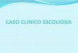 Caso clínico Junio - Escoliosis - Comité de NeuroAnestesia SCA
