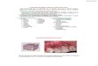 Lesiones elementales del-a-mucosa oral