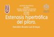 Estenosis hipertrofica del piloro