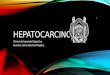 Hepatocarcinoma megara ppt
