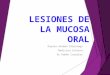 Lesiones de la mucosa oral
