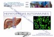 Hepatopatías autoinmunes. Anticuerpos asociados. Inmaculada 