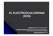 EL ELECTROOCULOGRAMA (EOG)