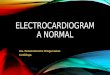 Electrocardiograma normal curso hgr 180