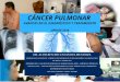 Cancer pulmonar dr. casanova 2016