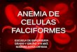 Anemia de celulas falciformes