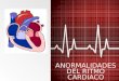 Anormalidades del ritmo cardiaco
