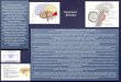 Infografía sobre psicofisiología de la formación reticular