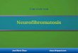 Convivir con neurofibromatosis