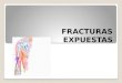 Clase 3.-fracturas-expuestas-y-pseudoartrosis