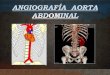 Angiografía Aorta Abdominal