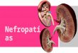 Nefropatias: sindrome nefrotico, sindrome nefritico, insuficiencia renal aguda e insuficiencia renal cronica