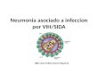 Neumonia asociado a infeccion por vih