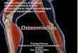 12 osteomielitis
