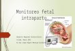 Monitoreo fetal intraparto