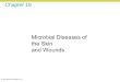 Microbiology Ch 19 lecture_presentation
