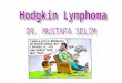 Hodgkin lymphoma presentation