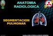 segmentacion pulmonar
