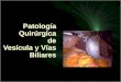 Patología quirúrgica de las vías biliares