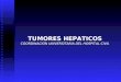 Tumores benignos y carcinoma hepatocelular