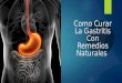 Como Curar La Gastritis Con Remedios Naturales