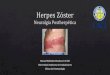 Herpes Zóster y Neuralgia Postherpética