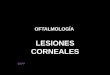 Lesiones corneales