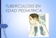 Tuberculosis en edad pediatrica