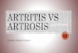 Artrosis VS Artritis