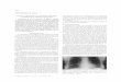 Presentación de casos - · PDF fileclínica, que se confirma por estudio anatomopatológico de las glándulas salivales menores, ... años antes presenta inflamación recurrente de