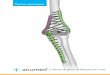 Técnica quirúrgica - · PDF file4 Técnica quirúrgica del sistema de placas de loqueo para codo cumed Placas para columna posterolateral Placas para columna lateral Placas para