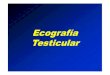 21.- Ecografia testicular [Modo de compatibilidad] · PDF fileEpididimitis aguda. Testículo normal. Epidídimo aumentado de tamaño. Pequeño hidrocele. Cubiertas testiculares engrosadas