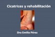 Cicatrices y rehabilitación - acmcb.es · PDF fileCaracterísticas clínicas: se eleva sobre la superficie de la piel en menor proporción que la cicatriz queloide, menos dura, mas