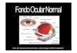 Dra. Mª Antonia Gil Hernández, oftalmóloga HUNS CandelariaFONDO+OJO… · Fondo de ojo normal, joven (con reflejos) Fondo de ojo normal. ... Vena Arteria Vena Arteria. Cruce arterio-venoso